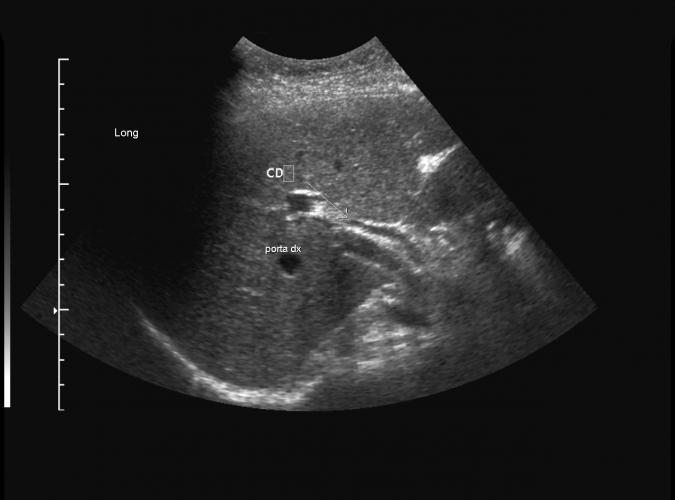 8a av  Catherine Olsson, sonograf